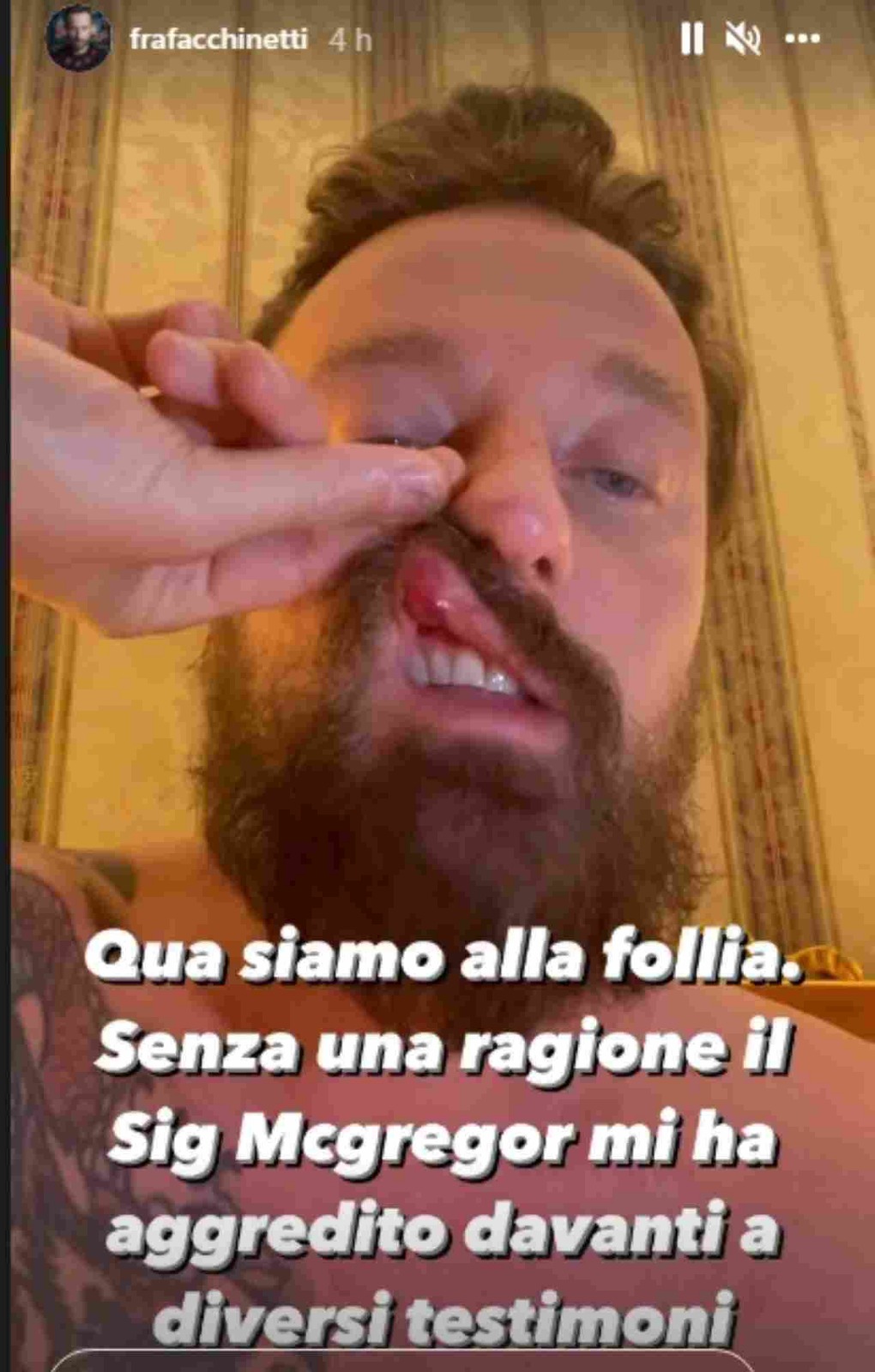 Francesco Facchinetti