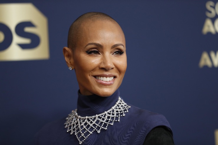 Jada Pinkett alopecia