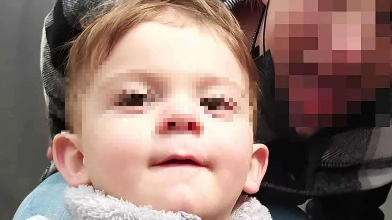 Bambino di 2 anni