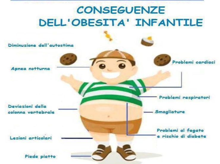 Obesità infantile